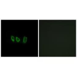 Invitrogen CSTL1 Polyclonal Antibody 100 &mu;L; Unconjugated:Antibodies,