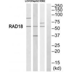 Invitrogen RAD18 Polyclonal Antibody 100 &mu;L | Buy Online | Invitrogen&trade; | Fisher Scientific