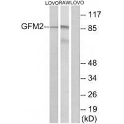 Invitrogen GFM2 Polyclonal Antibody 100 &mu;L | Buy Online | Invitrogen&trade; | Fisher Scientific