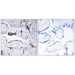 Invitrogen ELOVL3 Polyclonal Antibody 100 &mu;L; Unconjugated:Antibodies,