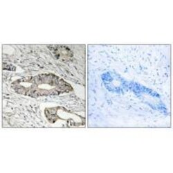 Invitrogen Epsin 3 Polyclonal Antibody 100 &mu;L | Buy Online | Invitrogen&trade; | Fisher Scientific