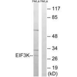 Invitrogen eIF3k Polyclonal Antibody 100 &mu;L; Unconjugated:Antibodies,