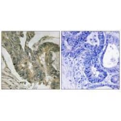 Invitrogen Aldolase C Polyclonal Antibody 100 &mu;L; Unconjugated:Antibodies,
