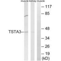 Invitrogen TSTA3 Polyclonal Antibody 100 &mu;L; Unconjugated:Antibodies,