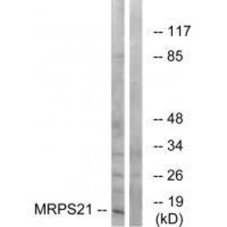Invitrogen MRPS21 Polyclonal Antibody 100 &mu;L | Buy Online | Invitrogen&trade; | Fisher Scientific
