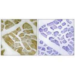Invitrogen Myosin 4 Polyclonal Antibody 100 &mu;L; Unconjugated:Antibodies,