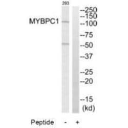Invitrogen MYBPC1 Polyclonal Antibody 100 &mu;L | Buy Online | Invitrogen&trade; | Fisher Scientific
