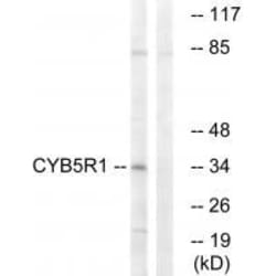 Invitrogen CYB5R1 Polyclonal Antibody 100 &mu;L; Unconjugated:Antibodies,