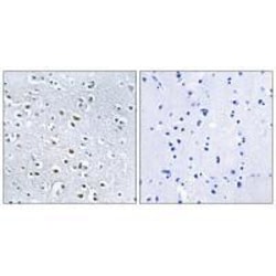 Invitrogen NPHP4 Polyclonal Antibody 100 &mu;L | Buy Online | Invitrogen&trade; | Fisher Scientific