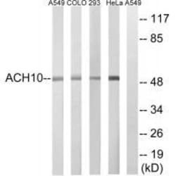 Invitrogen CHRNA10 Polyclonal Antibody 100 &mu;L | Buy Online | Invitrogen&trade; | Fisher Scientific