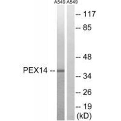 Invitrogen PEX14 Polyclonal Antibody 100 &mu;L | Buy Online | Invitrogen&trade; | Fisher Scientific