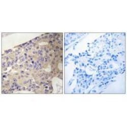 Invitrogen PEX10 Polyclonal Antibody 100 &mu;L; Unconjugated:Antibodies,