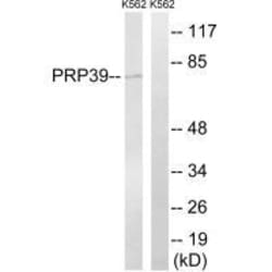 Invitrogen PRPF39 Polyclonal Antibody 100 &mu;L | Buy Online | Invitrogen&trade; | Fisher Scientific