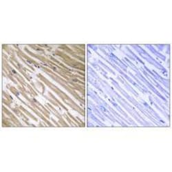 Invitrogen NDRG4 Polyclonal Antibody 100 &mu;L; Unconjugated:Antibodies,