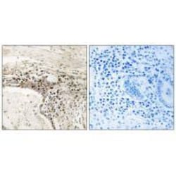Invitrogen SSH3 Polyclonal Antibody 100 &mu;L; Unconjugated:Antibodies,