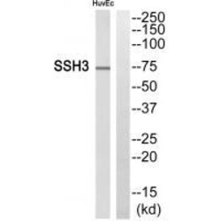 Invitrogen SSH3 Polyclonal Antibody 100 &mu;L | Buy Online | Invitrogen&trade; | Fisher Scientific