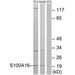 Invitrogen S100A16 Polyclonal Antibody 100 &mu;L | Buy Online | Invitrogen&trade; | Fisher Scientific