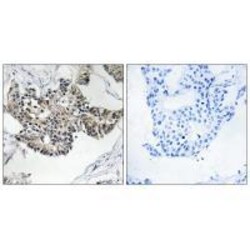 Invitrogen RSAD1 Polyclonal Antibody 100 &mu;L | Buy Online | Invitrogen&trade; | Fisher Scientific