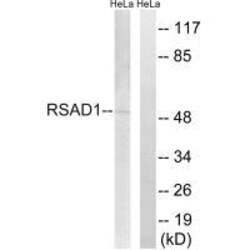 Invitrogen RSAD1 Polyclonal Antibody 100 &mu;L | Buy Online | Invitrogen&trade; | Fisher Scientific