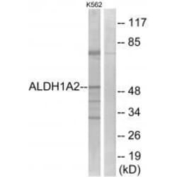 Invitrogen ALDH1A2 Polyclonal Antibody 100 &mu;L; Unconjugated:Antibodies,