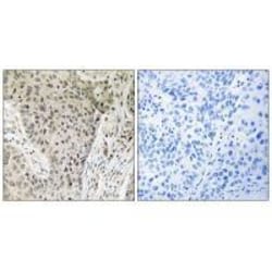 Invitrogen ARHGEF19 Polyclonal Antibody 100 &mu;L | Buy Online | Invitrogen&trade; | Fisher Scientific
