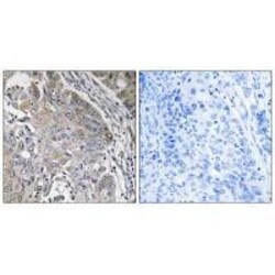 Invitrogen SPINK6 Polyclonal Antibody 100 &mu;L; Unconjugated:Antibodies,