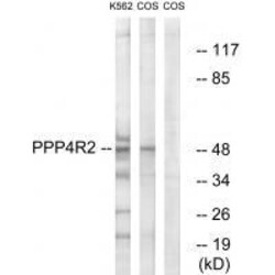 Invitrogen PPP4R2 Polyclonal Antibody 100 &mu;L | Buy Online | Invitrogen&trade; | Fisher Scientific