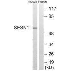 Invitrogen SESN1 Polyclonal Antibody 100 &mu;L; Unconjugated:Antibodies,