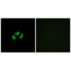 Invitrogen SCN7A Polyclonal Antibody 100 &mu;L; Unconjugated:Antibodies,