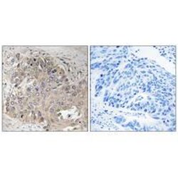 Invitrogen Spectrin beta-5 Polyclonal Antibody 100 &mu;L; Unconjugated:Antibodies,