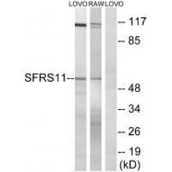 Invitrogen SRSF11 Polyclonal Antibody 100 &mu;L; Unconjugated:Antibodies,