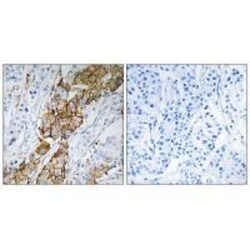 Invitrogen USP32 Polyclonal Antibody 100 &mu;L; Unconjugated:Antibodies,