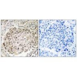Invitrogen USP36 Polyclonal Antibody 100 &mu;L; Unconjugated:Antibodies,