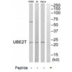 Invitrogen UBE2T Polyclonal Antibody 100 &mu;L; Unconjugated:Antibodies,