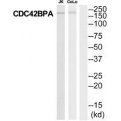 Invitrogen MRCK alpha Polyclonal Antibody 100 &mu;L | Buy Online | Invitrogen&trade; | Fisher Scientific