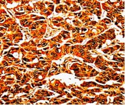 Invitrogen UPK3B Polyclonal Antibody 100 &mu;L; Unconjugated:Antibodies,