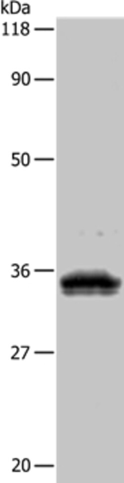 Invitrogen UPK3B Polyclonal Antibody 100 &mu;L | Buy Online | Invitrogen&trade; | Fisher Scientific