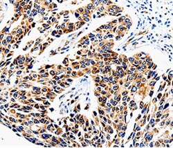 Invitrogen COX16 Polyclonal Antibody 100 &mu;L | Buy Online | Invitrogen&trade; | Fisher Scientific