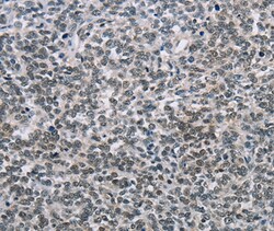Invitrogen NFKBIL2 Polyclonal Antibody 100 &mu;L | Buy Online | Invitrogen&trade; | Fisher Scientific