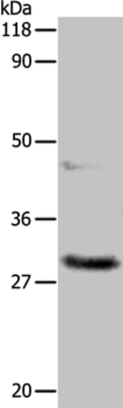 Invitrogen APIP Polyclonal Antibody 100 &mu;L; Unconjugated:Antibodies,