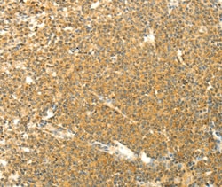 Invitrogen AARS2 Polyclonal Antibody 100 &mu;L; Unconjugated:Antibodies,