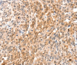 Invitrogen Annexin A8 Polyclonal Antibody 100 &mu;L; Unconjugated:Antibodies,