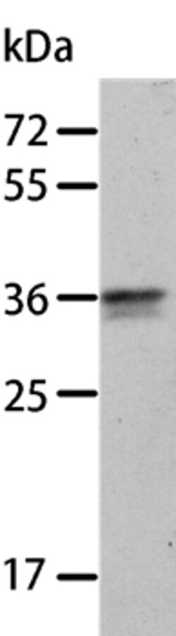 Invitrogen Annexin A8 Polyclonal Antibody 100 &mu;L | Buy Online | Invitrogen&trade; | Fisher Scientific