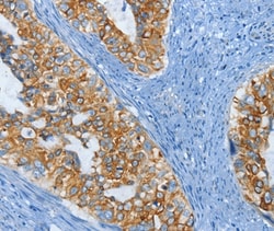 Invitrogen KRT81 Polyclonal Antibody 100 &mu;L; Unconjugated:Antibodies,