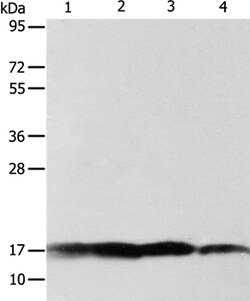Invitrogen ATP5J Polyclonal Antibody 100 &mu;L | Buy Online | Invitrogen&trade; | Fisher Scientific