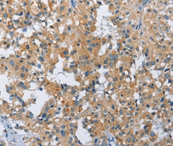 Invitrogen FGF9 Polyclonal Antibody 100 &mu;L; Unconjugated:Antibodies,