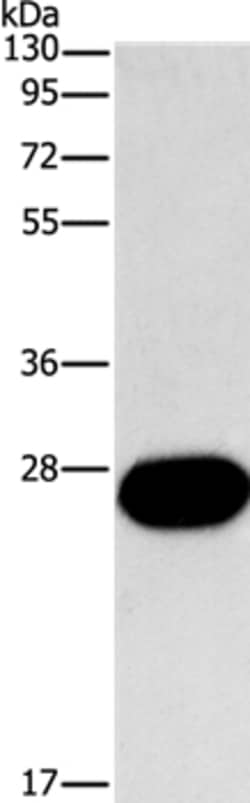 Invitrogen FGF9 Polyclonal Antibody 100 &mu;L; Unconjugated:Anticuerpos