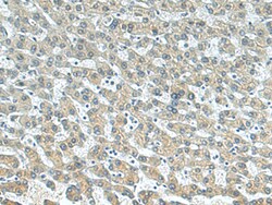 Invitrogen BTG3 Polyclonal Antibody 100 &mu;L; Unconjugated:Antibodies,
