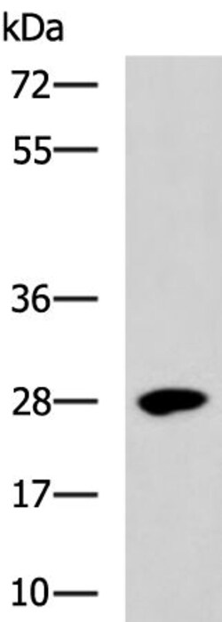 Invitrogen BTG3 Polyclonal Antibody 100 &mu;L | Buy Online | Invitrogen&trade; | Fisher Scientific