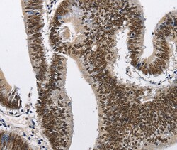 Invitrogen CMTM2 Polyclonal Antibody 100 &mu;L | Buy Online | Invitrogen&trade; | Fisher Scientific